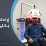 زراعة الشعر بالليزر في تركيا