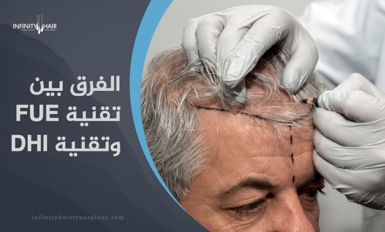 الفرق بين تقنية FUE وتقنية DHI في زراعة الشعر