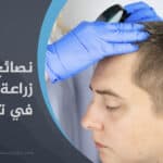 نصائح قبل زراعة الشعر في تركيا