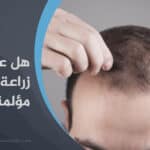 هل عملية زراعة الشعر مؤلمة، وهل يمكن زراعة الشعر بدون ألم